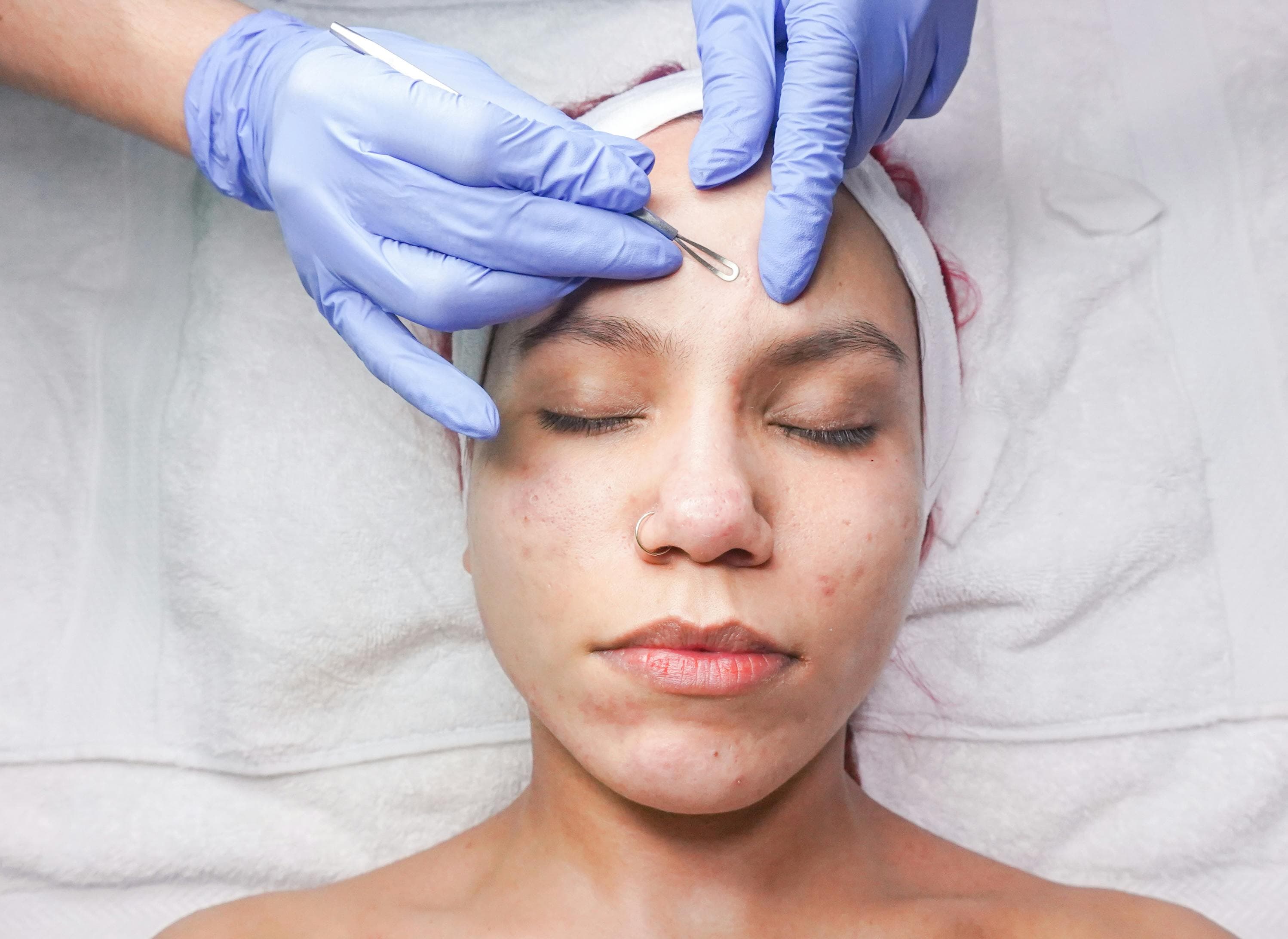 Tratamiento facial en Punta del Este – Alejandra Duarte 2